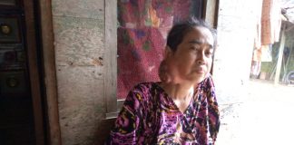 Warga Rancapinang Pandeglang Butuh Bantuan Dana untuk Berobat, Karena Idap Tumor Ganas